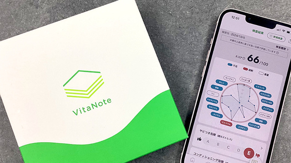 「食べている野菜、意味ある？」尿でわかる栄養の「答え合わせ」