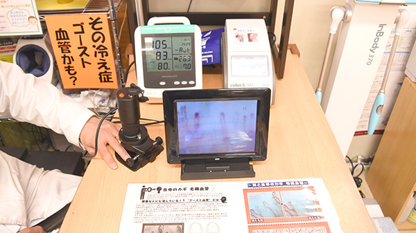 血管年齢測定器